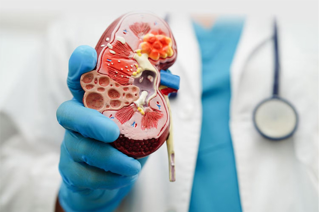 Renal Failure